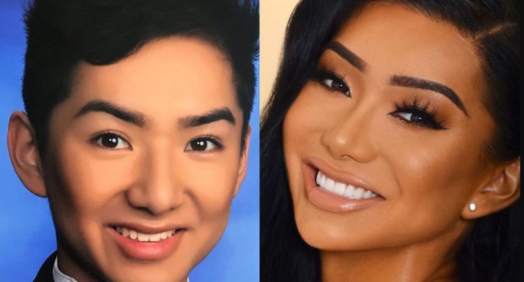 Nikita Dragun before and after plastic surgery photo